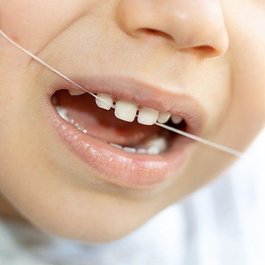 Jumpstart Your Child's Lifetime Flossing Habit - Euclid Dental Center - Euclid Dental Center -